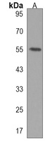 Anti-CENPI Antibody