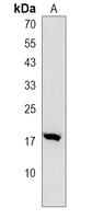 Anti-COX6A2 Antibody