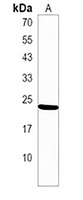 Anti-TIFA Antibody