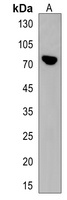 Anti-PLCZ1 Antibody