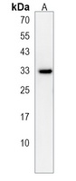 Anti-TMEM150A Antibody