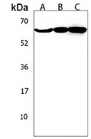 Anti-TCHP Antibody