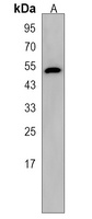 Anti-EYA4 Antibody