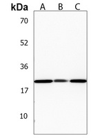 Anti-PNOC Antibody