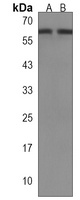 Anti-DOS Antibody