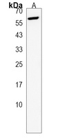 Anti-ACTR5 Antibody