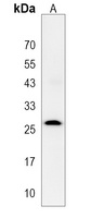 Anti-TSPAN6 Antibody