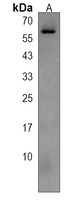 Anti-CDC73 Antibody