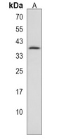 Anti-SLC25A17 Antibody