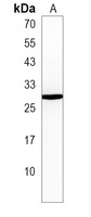 Anti-CCDC85B Antibody