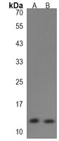 Anti-SPRR1B Antibody