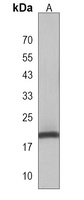 Anti-DLK2 Antibody