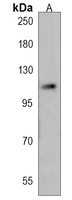 Anti-CXorf22 Antibody