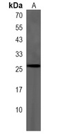 Anti-RAB8A Antibody