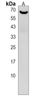 Anti-DTX1 Antibody