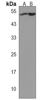 Anti-GAL3ST1 Antibody