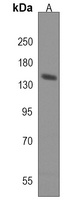 Anti-Adenylate Cyclase 8 Antibody