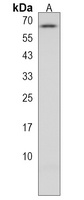 Anti-CTPS2 Antibody