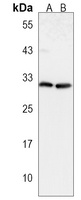 Anti-CTHRC1 Antibody