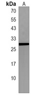 Anti-FNDC5 Antibody