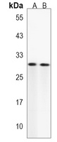 Anti-DIO2 Antibody