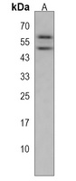 Anti-KMO Antibody