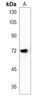 Anti-ACSS3 Antibody