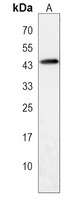 Anti-CECR5 Antibody