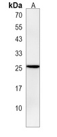 Anti-CIB2 Antibody