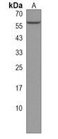 Anti-PFKFB1 Antibody