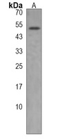 Anti-ANGPTL6 Antibody