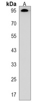 Anti-Semaphorin 3A Antibody