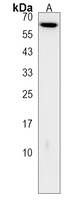 Anti-RYK Antibody