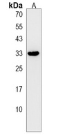 Anti-MPST Antibody