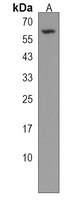 Anti-CDK17 Antibody