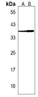 Anti-EN2 Antibody