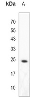 Anti-MOB1A Antibody