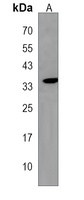 Anti-HMX2 Antibody