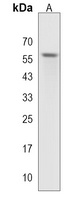 Anti-STK17A Antibody