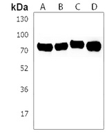 Anti-BRDT Antibody