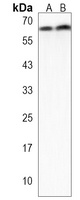 Anti-GALK2 Antibody