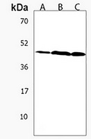 Anti-C9orf156 Antibody