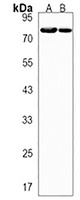 Anti-SRP72 Antibody