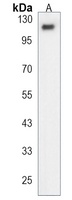 Anti-ESPN Antibody