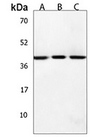 Anti-HSD17B7 Antibody