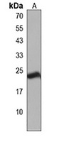 Anti-SPCS3 Antibody