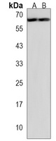 Anti-PRELP Antibody