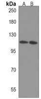 Anti-CTDP1 Antibody