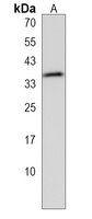Anti-DSCR3 Antibody
