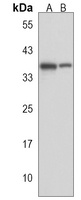Anti-PARP16 Antibody